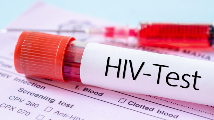 Miasto przekaże 10 tysięcy zł na bezpłatne, anonimowe badania na HIV Miasto przekaże 10 tysięcy zł na bezpłatne, anonimowe badania na HIV - fot. CC0 license